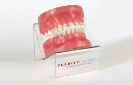Чим брекети clarity виділяються серед конкурентів (брекети clarity) Чим брекети clarity виділяються серед конкурентів