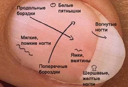 Що кажуть нігті про наше здоров'я, 100 рад (здоров'я) Що кажуть нігті про наше здоров'я, 100 рад