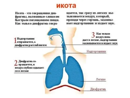 Що потрібно зробити, для того щоб позбутися від гикавки (того) Що потрібно зробити, для того щоб позбутися від гикавки