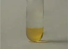Що таке лімфа