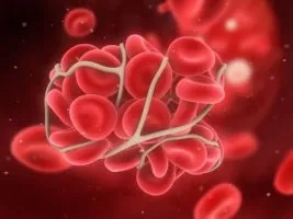 Що таке коагуляція, ніж вона може бути викликана, які ускладнення можливі в результаті (може) Що таке коагуляція, ніж вона може бути викликана, які ускладнення можливі в результаті