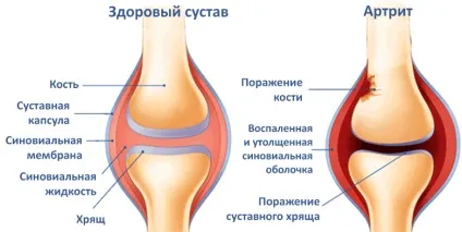 Ципко на руках і ногах не вирок