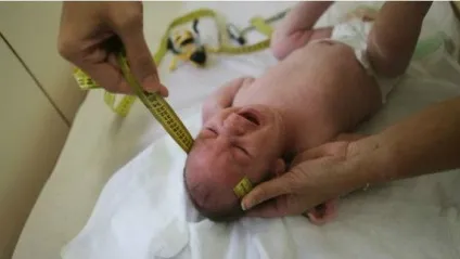 Що таке вірус ЗІКу (13 фото) - Трініксі