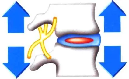 Доктор диск купити з доставкою по Москві - doctor disk waist розтягує пояс для хребта (доктор) Доктор диск купити з доставкою по Москві - doctor disk waist розтягує пояс для хребта