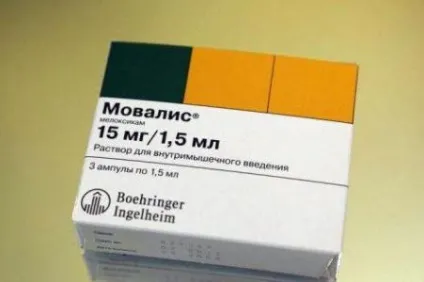 Доа тазостегнового суглоба симптоми, ступеня і лікування (доа тазостегнового суглоба) Доа тазостегнового суглоба симптоми, ступеня і лікування