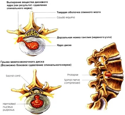Доктор диск купити з доставкою по Москві - doctor disk waist розтягує пояс для хребта (doctor) Доктор диск купити з доставкою по Москві - doctor disk waist розтягує пояс для хребта