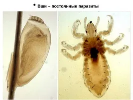 Ефективні препарати в боротьбі з котячої двуусткой у людини (препарати) Ефективні препарати в боротьбі з котячої двуусткой у людини