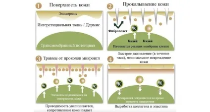 Ефективність фракційної мезотерапії шкіри обличчя, відгуки і ціни