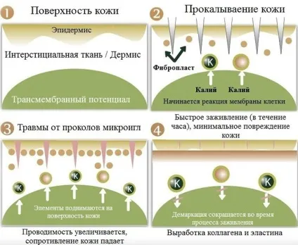 Фракційна мезотерапія шкіри обличчя, тіла і голови відгуки, фото до і після, ціни