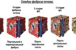 Гепатит з у дітей симптоми, ознаки, діагностика, лікування (дітей) Гепатит з у дітей симптоми, ознаки, діагностика, лікування