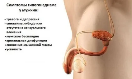 Гіпогонадизм у чоловіків що це причини і лікування (гіпогонадизм) Гіпогонадизм у чоловіків що це причини і лікування