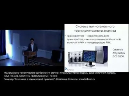 Гормонозалежний рак молочної залози не лікують хіміотерапією у жінок, прогноз (хіміотерапією) Гормонозалежний рак молочної залози не лікують хіміотерапією у жінок, прогноз