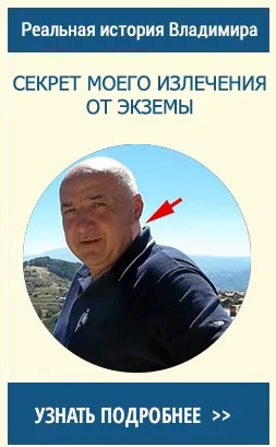 Справжня екзема симптоми і лікування захворювання (лікування) Справжня екзема симптоми і лікування захворювання