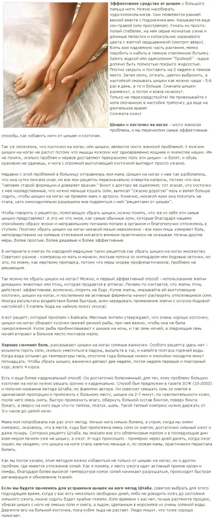 Як позбутися від шишок на ногах або на лобі в домашніх умовах (умовах) Як позбутися від шишок на ногах або на лобі в домашніх умовах