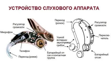 Як зробити слуховий апарат своїми руками (зробити) Як зробити слуховий апарат своїми руками
