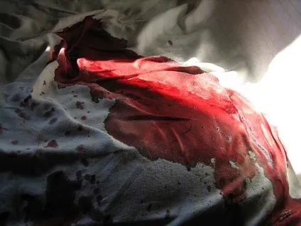 Як вивести кров з матраца 5 методів (матраца) Як вивести кров з матраца 5 методів