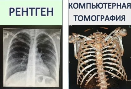 Комп'ютерна томографія в питаннях і відповідях (комп'ютерна) Комп'ютерна томографія в питаннях і відповідях