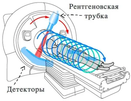 Комп'ютерна томографія в питаннях і відповідях (комп'ютерна) Комп'ютерна томографія в питаннях і відповідях