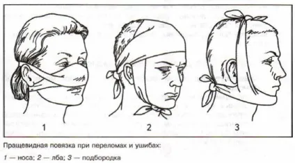 Косиночная пов'язка