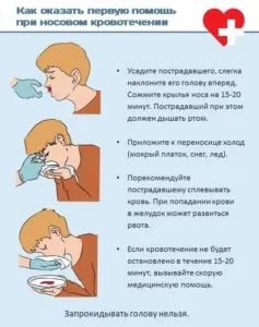 Кров з носа вранці причини у дорослих і дітей (причини) Кров з носа вранці причини у дорослих і дітей