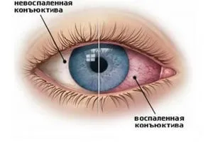 Куріння і зір негативний вплив тютюну (зір) Куріння і зір негативний вплив тютюну