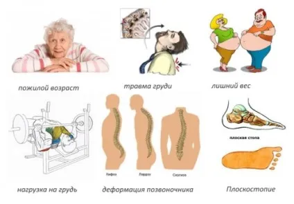 Лікування грудного спондилоартроз народними засобами (лікування) Лікування грудного спондилоартроз народними засобами