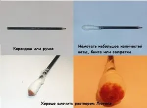Люголь при ангіні розчин і спрей, чи допомагає (допомагає) Люголь при ангіні розчин і спрей, чи допомагає
