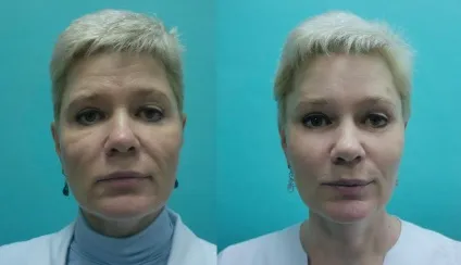 Малярські мішки на вилицях (мішки) Малярські мішки на вилицях