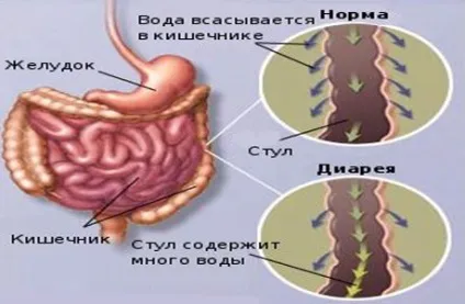 Рідкий стілець вранці можливі причини, ніж лікувати (рідкий стілець вранці) Рідкий стілець вранці можливі причини, ніж лікувати