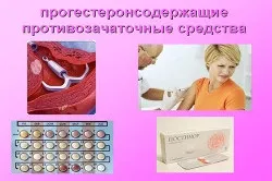 Міома матки невеликих розмірів причини, ознаки і лікування (хвороби матки) Міома матки невеликих розмірів причини, ознаки і лікування