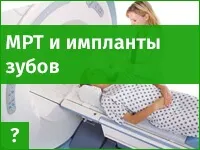Чи можна проводити магнітно-резонансну томографію (МРТ) при наявності зубних імплантів (імплантатів) (магнітно-резонансна) Чи можна проводити магнітно-резонансну томографію (МРТ) при наявності зубних імплантів (імплантатів)