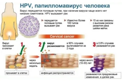 На тілі багато паппілом що робити і як лікувати (треба відразу звертатися) На тілі багато паппілом що робити і як лікувати