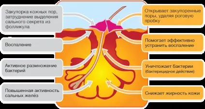 Олена Малишева про лікування прищів, як допомагає instaskin (instaskin) Олена Малишева про лікування прищів, як допомагає instaskin