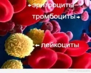 Залишкова сеча в сечовому міхурі при аденомі, норма залишкової сечі (сечовому) Залишкова сеча в сечовому міхурі при аденомі, норма залишкової сечі