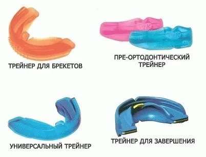 Ортодонтія, брекети