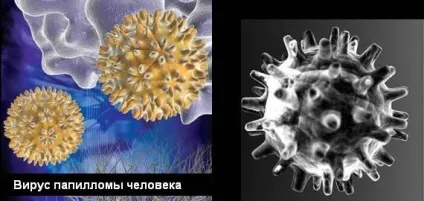 Від чого з'являються бородавки, звідки беруться і які заходи профілактики існують (причини бородавок) Від чого з'являються бородавки, звідки беруться і які заходи профілактики існують