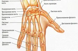 Перелом кисті руки симптоми і лікування (удари) Перелом кисті руки симптоми і лікування