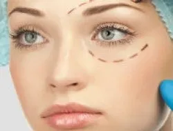 Періорбітальна область методи корекції, cosmex