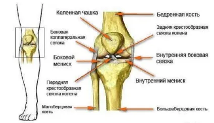 Перелом колінної чашечки симптоми і наслідки