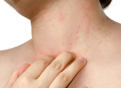 Поліестер - що це за тканина склад, догляд, прання, виведення плям (догляд) Поліестер - що це за тканина склад, догляд, прання, виведення плям