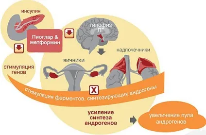 Полікістоз яєчників причини, симптоми, діагностика та лікування синдрому полікістозних яєчників