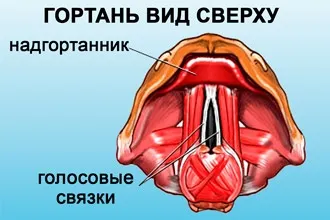 Наслідки і ускладнення ларингіту - чим він небезпечний (небезпечний) Наслідки і ускладнення ларингіту - чим він небезпечний