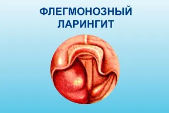 Наслідки і ускладнення ларингіту - чим він небезпечний (гортані спричиняє собою) Наслідки і ускладнення ларингіту - чим він небезпечний