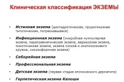 причини екземи