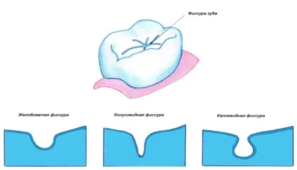 Проф карієсу кс