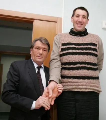 Найбільші руки в світі, цікаві факти (найдовшими руками) Найбільші руки в світі, цікаві факти