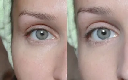 Сяюча шкіра від clinique і lumene відгуки (AirBrush Concealer Clinique) Сяюча шкіра від clinique і lumene відгуки