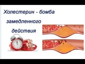 Статини, що це таке можливість чудесного зцілення або загроза здоров'ю (каменів жовчних протоках) Статини, що це таке можливість чудесного зцілення або загроза здоров'ю
