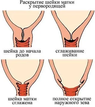 Сутички інтервал між ними і як розпізнати наступаючі пологи (інтервал) Сутички інтервал між ними і як розпізнати наступаючі пологи