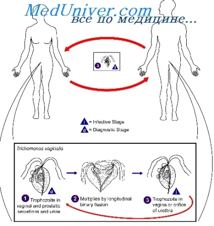 Трихомоніаз та його причини